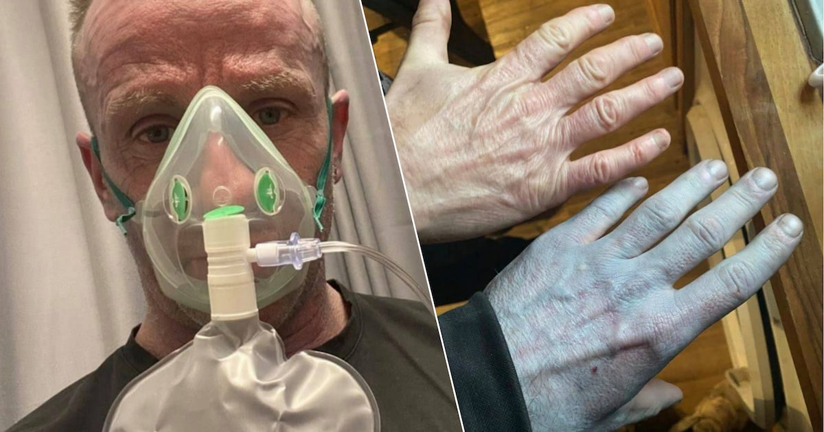 Il se réveille avec la peau bleue et affole les urgences: voici ce qui lui  est vraiment arrivé | 7sur7.be