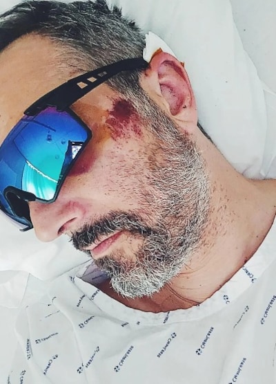 Ghinzu contraint d’annuler des concerts après une lourde chute à vélo de son chanteur