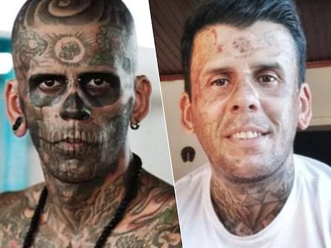 L’incroyable transformation de l’un des hommes les plus tatoués au monde: “Atrocement douloureux”