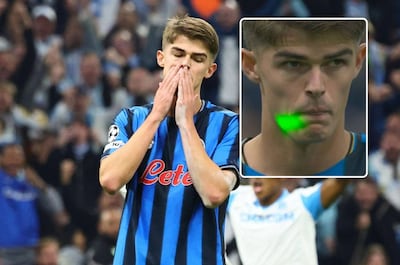 Le penalty raté de Charles De Ketelaere à l'OM: a-t-il été gêné par un laser?