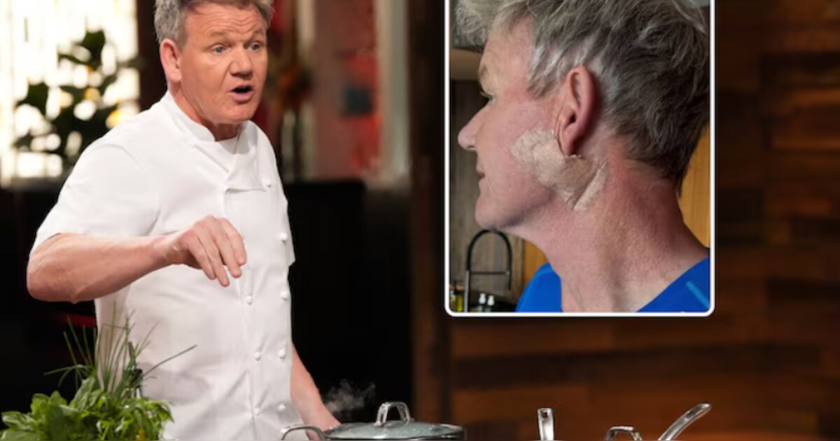 “Ce n’est pas un lifting”: le chef Gordon Ramsay opéré d’un cancer de ...