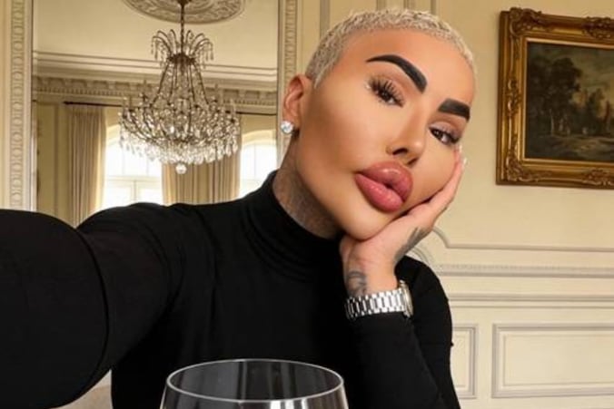 Il rêvait de ressembler à Kim Kardashian: un influenceur britannique décède  à 34 ans | 7sur7.be