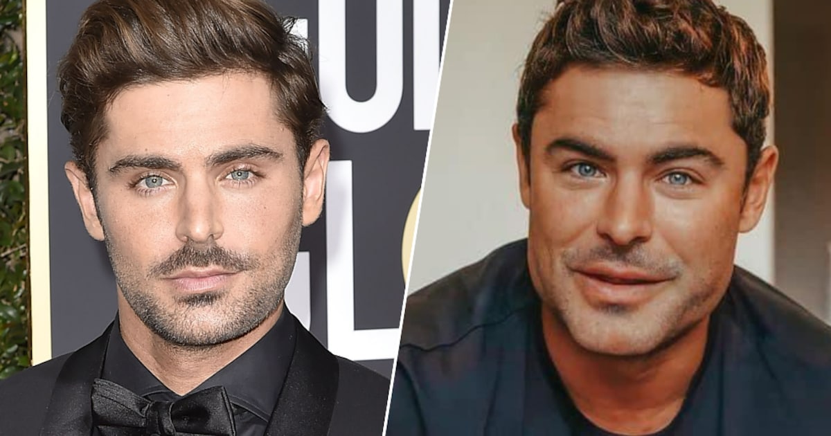 chirurgie-esth-tique-zac-efron-d-voile-enfin-la-vraie-raison-de-sa